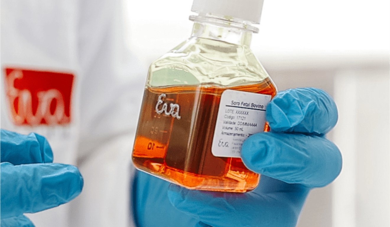 O que é o soro fetal bovino
